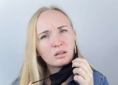 Woman removes the protective mask and shows irritation on face skin. Antiviral measures. Means of protectionの写真素材