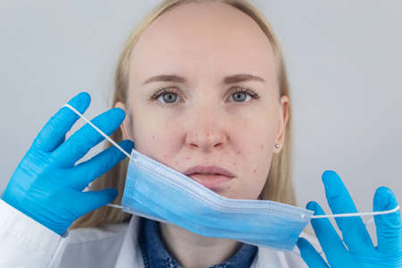 Doctor removes the protective mask and shows irritation on face skin. Antiviral measures. Means of protectionの写真素材