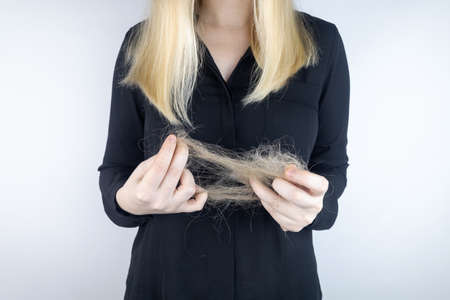 Close-up of a girl whose hair is falling out. There is a large tuft of tangled curls on the comb. The blonde looks upset into the frame. The concept of women problems with the scalpの写真素材