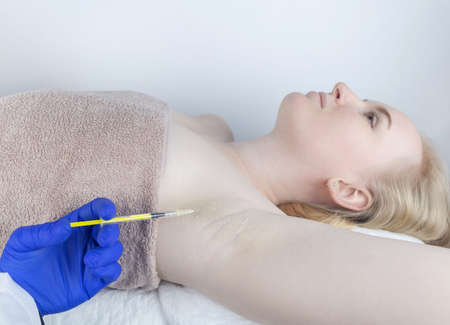 Armpit injection botulinum toxin. Cream marking for injection sites. Pain relief before the procedure. local anesthesia. Anhidrosis therapy. Decreased sweating. Eliminates unpleasant underarm odor.の写真素材