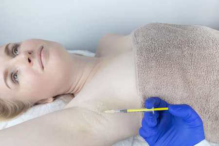 Armpit injection botulinum toxin. Cream marking for injection sites. Pain relief before the procedure. local anesthesia. Anhidrosis therapy. Decreased sweating. Eliminates unpleasant underarm odor.の写真素材
