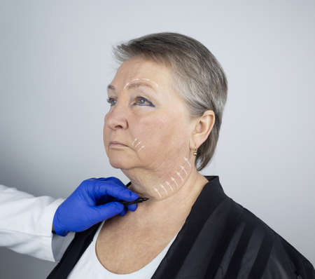 An elderly woman at the reception of a facial plastic surgeon. Consultation on the removal of age wrinkles on the face. The doctor shows what procedures he will do. Mimic wrinkles. Contour plasticの写真素材