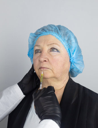 Botulinum toxin injection. Senior woman at the appointment with a beautician who is preparing to give anti-wrinkle injections. Loose skin and hypotension. Mimic wrinkles and contouringの写真素材