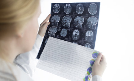 Epileptologist examines patient MRI and electroencephalogram. Concept treating epilepsy and helping people who suffer from this disease. Neurologist at work. Pathology of the brain. Seizure activityの写真素材