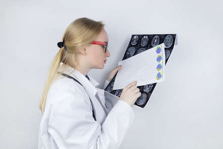 Epileptologist examines patient MRI and electroencephalogram. Concept treating epilepsy and helping people who suffer from this disease. Neurologist at work. Pathology of the brain. Seizure activityの写真素材