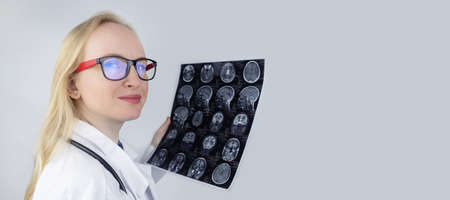Epileptologist examines patient MRI and electroencephalogram. Concept treating epilepsy and helping...