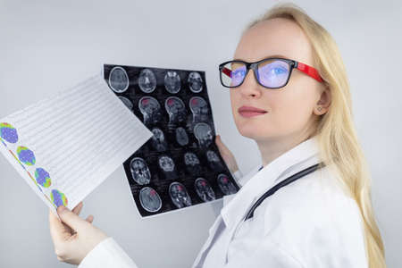 Epileptologist examines patient MRI and electroencephalogram. Concept treating epilepsy and helping people who suffer from this disease. Neurologist at work. Pathology of the brain. Seizure activityの写真素材