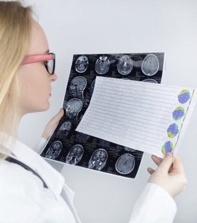 Epileptologist examines patient MRI and electroencephalogram. Concept treating epilepsy and helping...