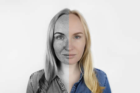 Ultraviolet rays on skin. Protective cream test. On the left, the skin is unprotected and stains...