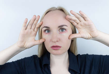 Allergy to cosmetics. The girl looks at the pimples around her eyes that appeared after using toxic cosmetics. Red spots on woman skinの写真素材