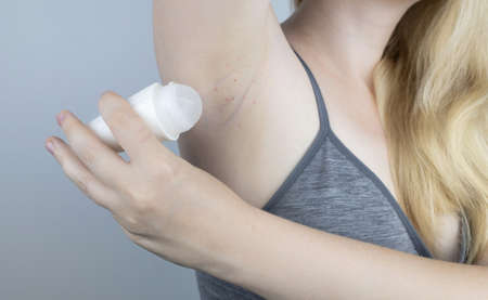 Armpit rash. Underarm skin irritation. Blonde girl shows irritation on the skin after using a razor, trimmer, deodorant or antiperspirant. Allergy or irritation. Acne or red spotsの写真素材