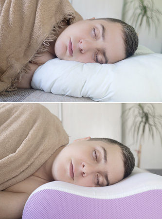 before and after. On one frame, mimic folds from the wrong pillow. There are no wrinkles in the other photo, as an orthopedic pillow is used. Cosmetology and dermatologyの写真素材