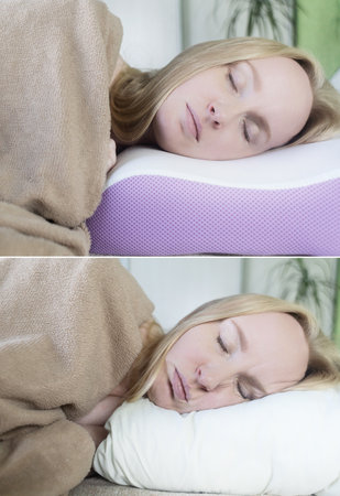 before and after. On one frame, mimic folds from the wrong pillow. There are no wrinkles in the other photo, as an orthopedic pillow is used. Cosmetology and dermatologyの写真素材