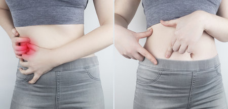 Pain in the right side. The girl holds on to the right side of the abdominal cavity. Appendicitis, pancreatitis, rib pain. On the right photo It shows that there is no pain. Treatment and healthcareの写真素材