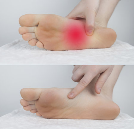 before and after. Sole of the foot pain, tendon sprains, inflammation, flat feet, bursitis, fasciitis. disease treatment concept. On left, she found an injury, on right, she had already been curedの写真素材