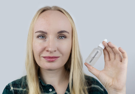 Vitamin A, Retinol, Niacinamide, Vitamin C. Girl smears her face with antioxidant anti-wrinkle cream. Anti-aging and facial rejuvenation agent. Before and after. Visual result. Acne treatmentの写真素材