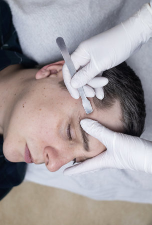 A dermatologist takes a skin scraping and tests for demodicosis and dermatitis, fungal infection. Close-up of a male patient's face at a doctor's appointmentの写真素材