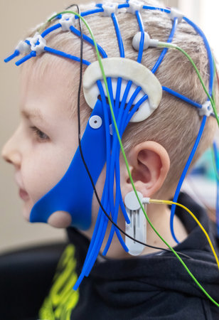 A boy's brain is examined on an EEG machine. Electroencephalogram is performed in a hospital laboratory to detect neurological diseases. Encephalogram for childrenの写真素材