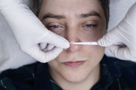 Man undergoing facial cleansing and blackhead removal. Beautician using comedone extractor or uno loop. Professional skin care in a beauty salonの写真素材