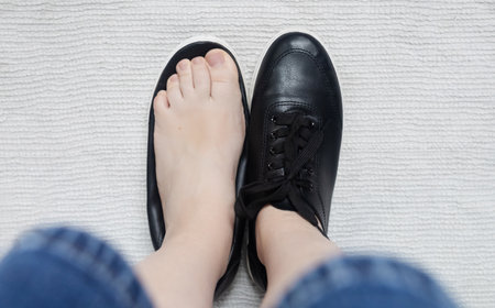 Foot deforming shoes. Incorrect anatomical shoes with flat soles. Small insole size, which causes foot pain. Cause of valgus, callsuses, ingrown toenailsの写真素材