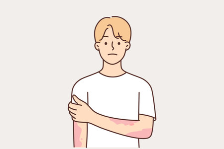 Man suffering from dermatitis and skin diseases with spots on hands needs help of dermatologistのイラスト素材