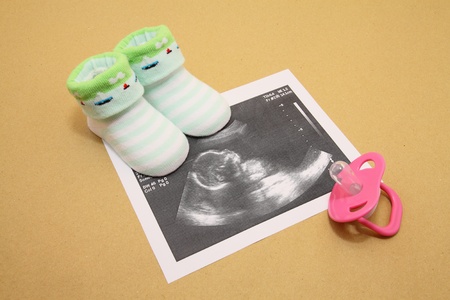 Baby socks with ultrasound images and pacifierの写真素材