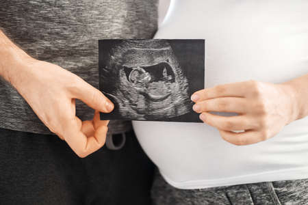 pregnant couple holding ultrasound scan