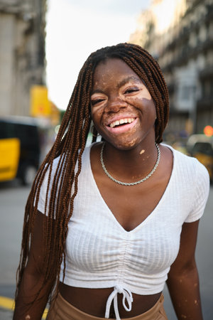 African American woman with vitiligo looking at the camera and smiling while standing outdoors on the street.の写真素材