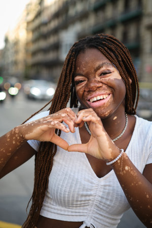African American woman with vitiligo smiling at camera and making heart shape with hands while standing on the street.の写真素材