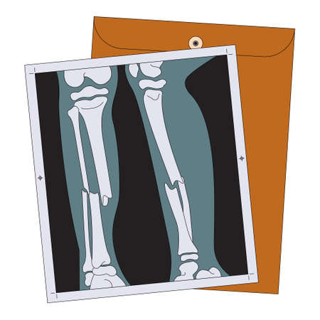 Disability illustration vector. This vector is perfectly crafted for various purposes on the topic of: Disabilityのイラスト素材