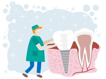 Dental implant. Dentist holding in hand of dentures. Medical equipment. Tooth treatment. Vector illustration flat design. Stomatology on background.のイラスト素材