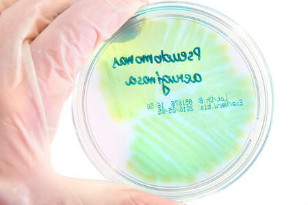 Hand in glove holding Petri plate with bacteria Pseudomonas Aeruginosaの写真素材