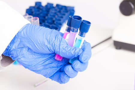 Lab technician working with equipment  microscope, test tubes  filled with colored fluid, chemical flasksの写真素材