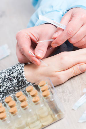 Acupuncture therapist applying acupuncture needle to her client's handの写真素材