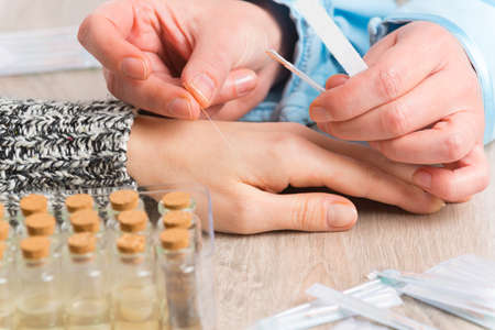 Acupuncture therapist applying acupuncture needle to her client's handの写真素材