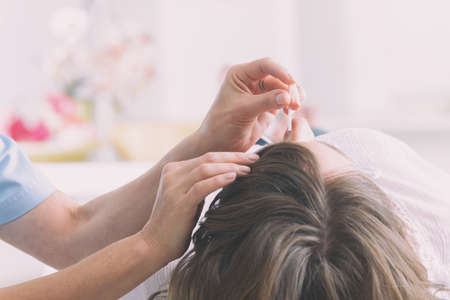 Acupuncture therapist applying acupuncture needle to her client's head