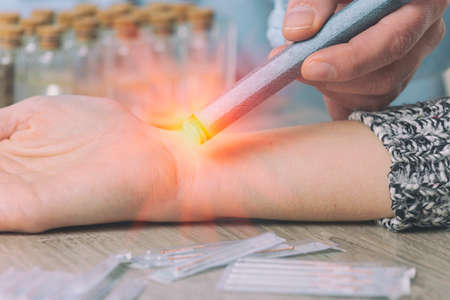 Alternative medicine therapist doing moxa treatment on her clientの写真素材