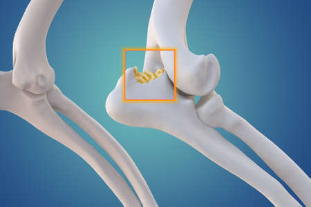 Canine Arthritis and Osteoarthritis joint inflammation, deterioration of joint in dogs, elbow joint,...