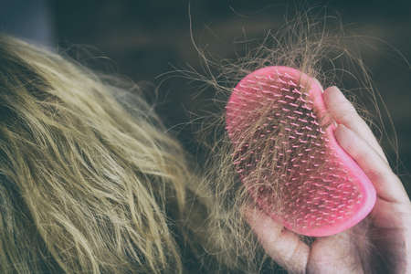 Hair loss problem. Female hand holding hairbrush with hair.の写真素材