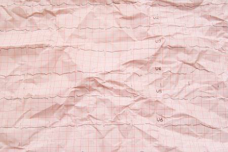 Cardiogram Tape Graph, backgroundの写真素材