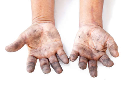 Dirty hand on white background