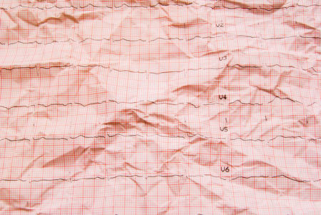 Electrocardiogram, EKGの写真素材