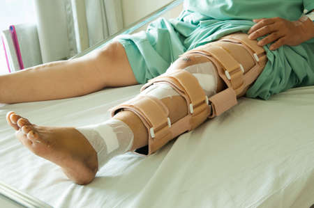woman wearing a leg brace, Broken legの写真素材