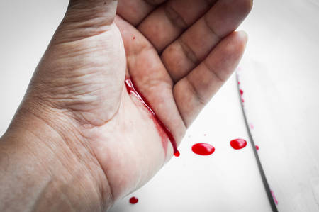 Kitchen Accident with Knife and Bloodの写真素材