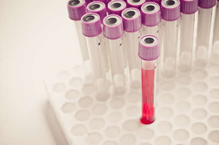 Blood test - sample specimen, laboratoryの写真素材