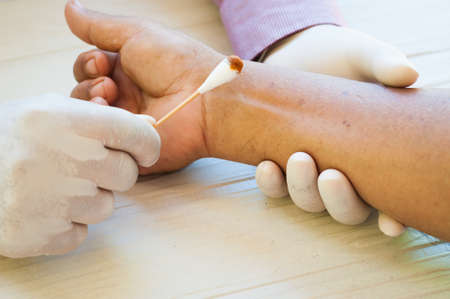 Medical concept, doctor dressing wound at the emergency roomの写真素材