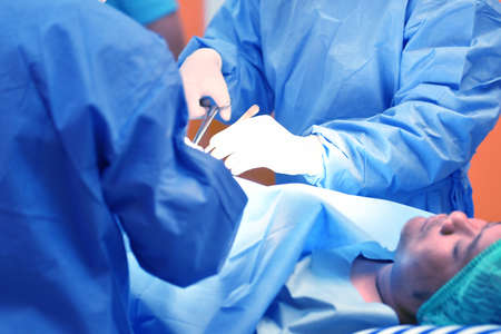 Team surgeon at work on operating room in hospitalの写真素材