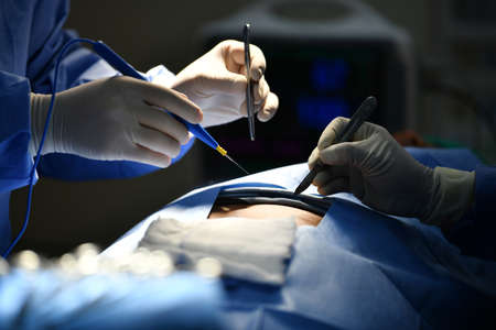 Team surgeon at work on operating room in hospitalの写真素材