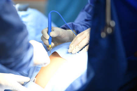Team surgeon at work on operating room in hospital