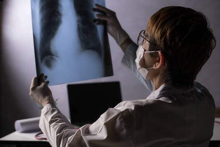 Medical doctor looking worried when inspecting x-ray film of lungs during COVID-19 pandemic outbreak crisisの写真素材